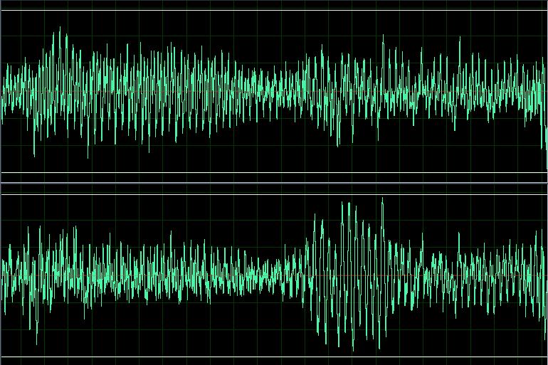 Digital audio waveform showing how voice samples are represented as data